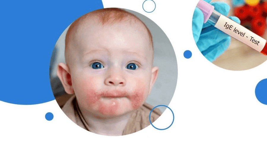 ĐỪNG ĐỂ DỊ ỨNG LÀ BÍ ẨN