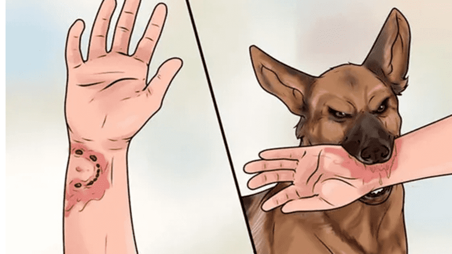 VẮC XIN VÀ HUYẾT THANH KHÁNG DẠI – BẢO VỆ SỨC KHỎE TRƯỚC NGUY CƠ BỆNH DẠI