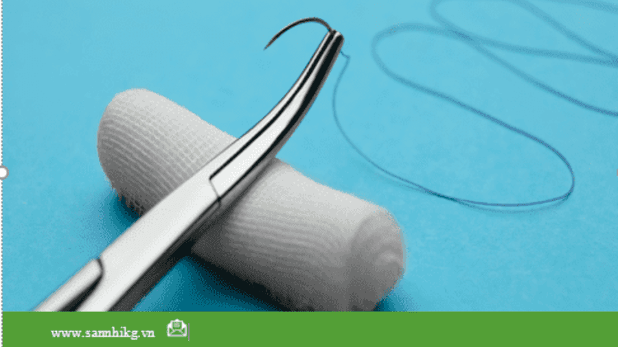 Chỉ phẫu thuật có chứa chất kháng khuẩn