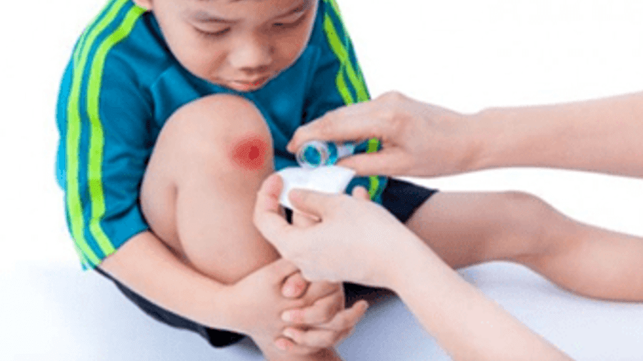 PHÒNG NGỪA TÉ NGÃ Ở TRẺ EM