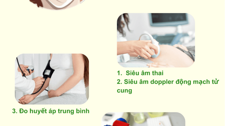 MẸ BẦU CẦN BIẾT GÌ VỀ TIỀN SẢN GIẬT?