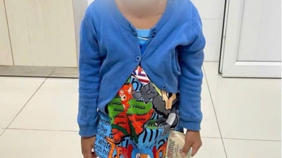 Hy hữu một bé gái 4 tuổi nuốt kẹo cao su liên tục trong nhiều tháng