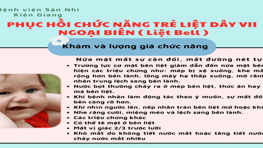 PHỤC HỒI CHỨC NĂNG CHO TRẺ LIỆT DÂY VII NGOẠI BIÊN (LIỆT BELL)